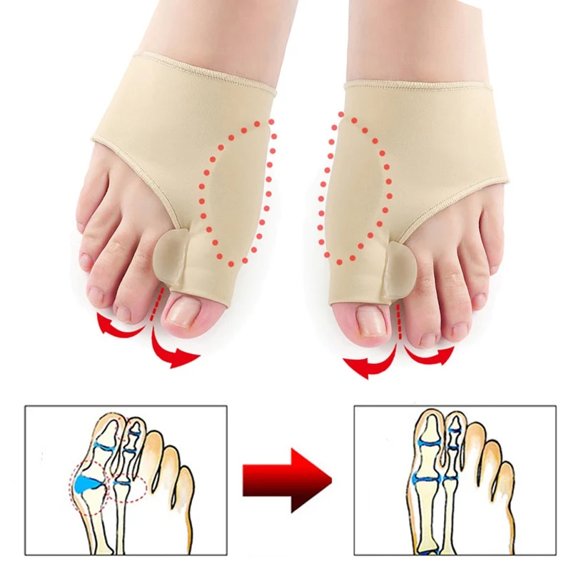 Duimregelaar Correctie Pedicure Sokken Stijltang
